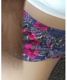 Abercrombie&Fitch | パンツ