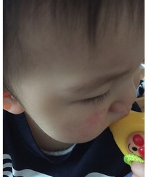 まさかのケガ‼︎ | その他