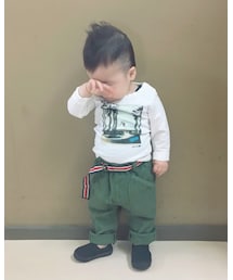 ⭐️ | 花粉症‥かも😭😭💦(その他)