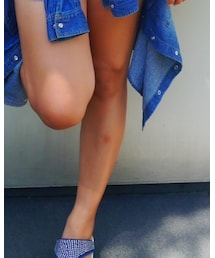 蚊に噛まれた | その他