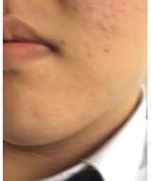 Supreme  | Tシャツ/カットソー