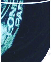 STUSSY | Tシャツ/カットソー