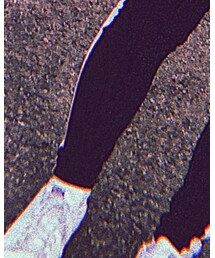 adidas | スニーカー