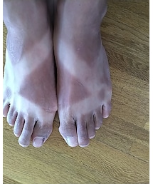 サンダルやけw | その他