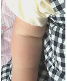 ちぎりパンの隙間日焼けして白い〜☀️ | ママ＆ベビー