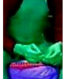 左乳首 | その他