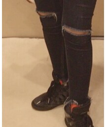 adidas | スニーカー