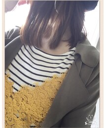 ビスチェ💖 | その他