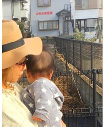 もうちょっとでハゲ無くなるね♡ | その他