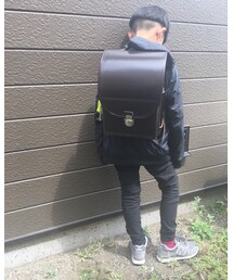 黄色いカバー取れました | その他