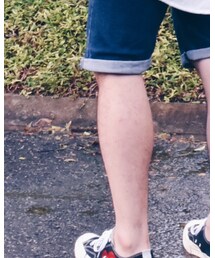 COMME des GARCONS | スニーカー