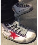 GOLDEN GOOSE(ゴールデングース)の「シューズ(スニーカー)」