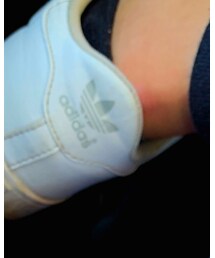 adidas | スニーカー