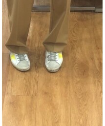 GOLDEN GOOSE | スニーカー