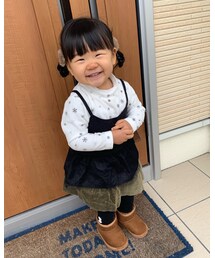 鼻赤くなるのはパパの遺伝💗 | その他