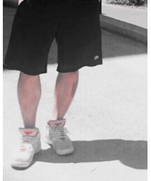 痛々しいすり傷 | その他