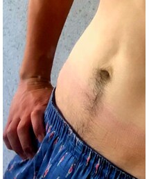 コンプレッションウェアの跡 | デニムスカート