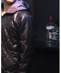 ガラス突っ込んで4,5針の傷 | ダウンジャケット/コート