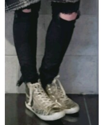 GOLDEN GOOSE | スニーカー