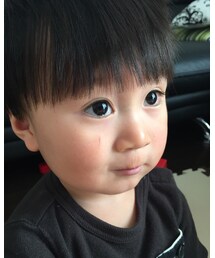 傷が… | その他