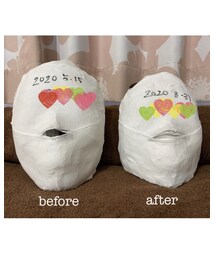 小顔矯正ビフォーアフター✨ | 渾身の作✨(その他)