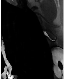 H&M | シャツ/ブラウス