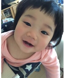 昨日のBBQで虫に目を刺されて腫れちゃいました😭😭 | その他