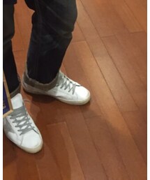 GOLDEN GOOSE | スニーカー