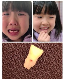 歯が抜けた🦷 | ラッピングキット