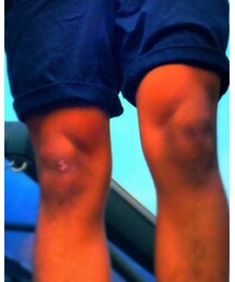 もも筋 | その他