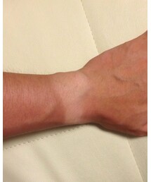 日焼け | その他