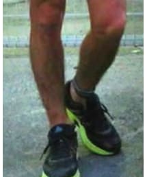 adidas | スニーカー