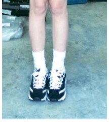 SKECHERS | スニーカー