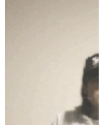 鼻詰まり酷くて口呼吸 | その他