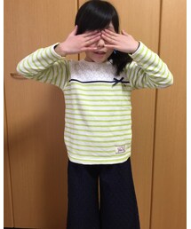 目がかゆ〜い。。。 | その他