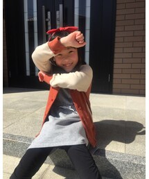 日焼けする〜(>_<) | その他