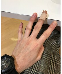 📸 🚨ご飯作ってたら負傷 w 🚨📸 | その他