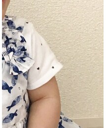 next | ロンパース