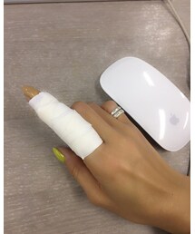 指負傷 | その他