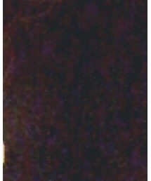 H&M | サロペット/オーバーオール