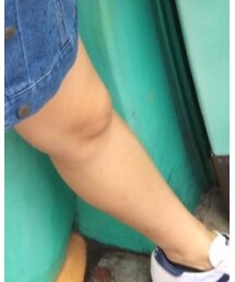 adidas | スニーカー