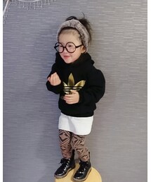 どうしてもあなたはすぐしゃくれる | その他