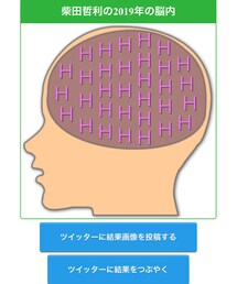 僕の頭はエッチみたい笑 | ボクサーパンツ