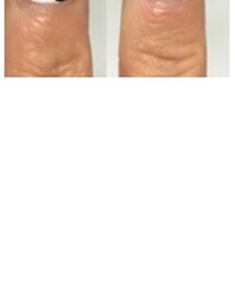 nail | マニキュア/ジェルネイル