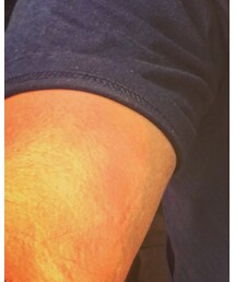 adidas | スニーカー