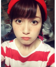 そばかす | その他