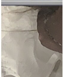 WEGO | シャツ/ブラウス