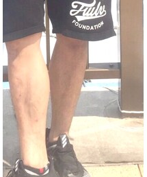 adidas | スニーカー