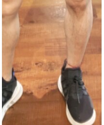 adidas | スニーカー