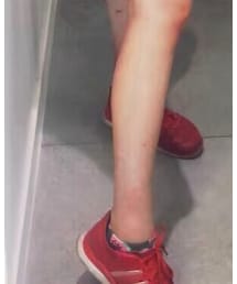 adidas | スニーカー